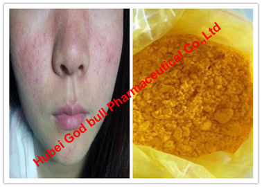 Κίνα Κίτρινες ακατέργαστες στεροειδείς σκόνες χρώματος/Isotretinoin για τους καρκίνους δερμάτων, CAS 4759-48-2 προμηθευτής